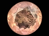 Triplite Single Round Moderately included